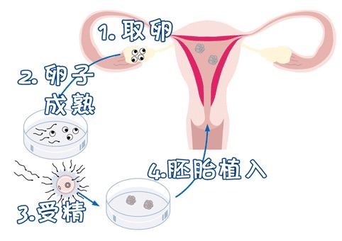 嘉会医疗